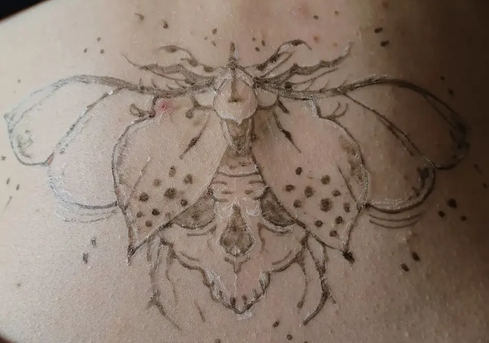 Černá henna. Místo potěchy oka nechtěné jizvy